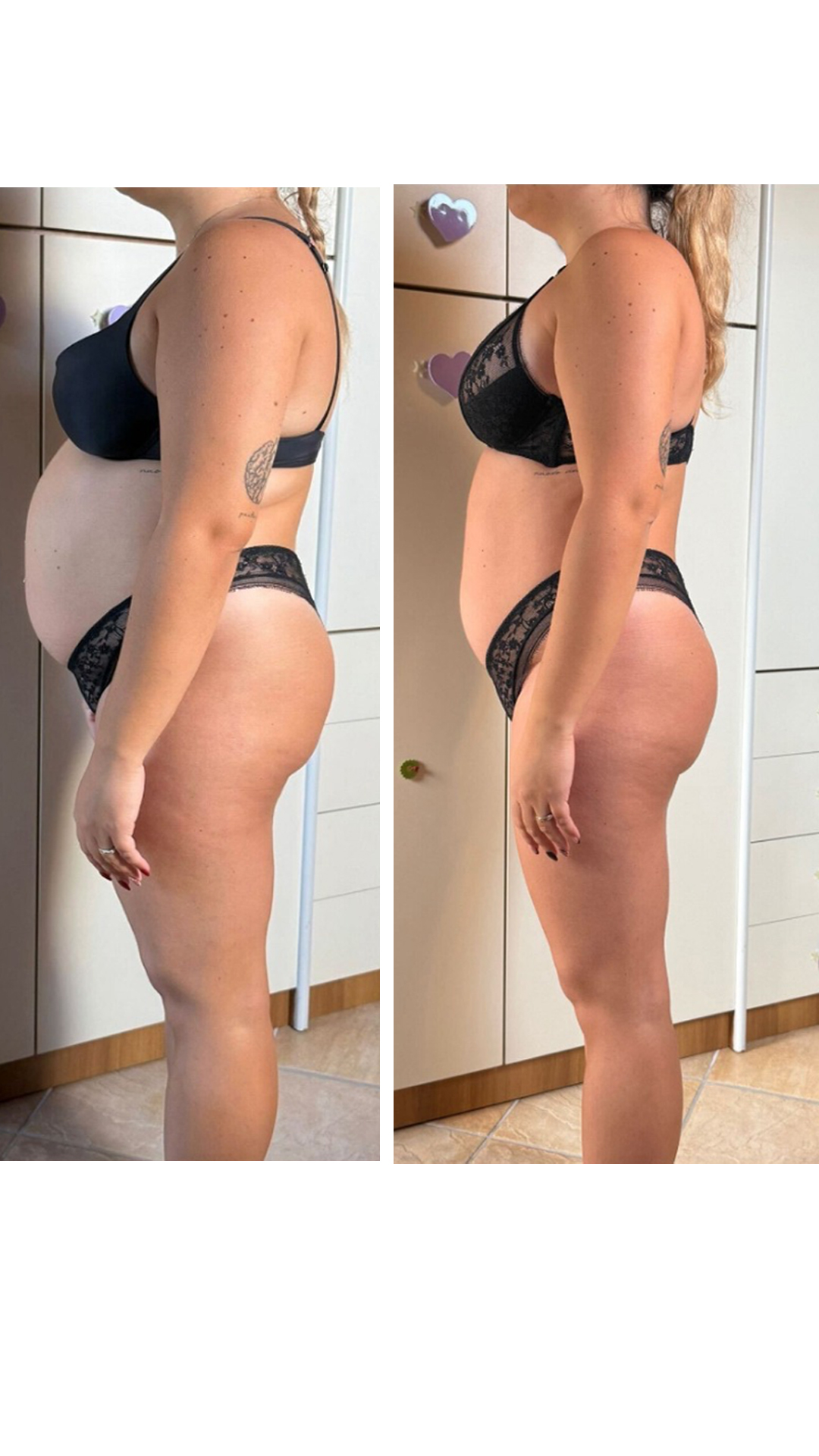 Antes y después: Sandra, programa RevolucionaT
